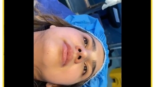 عمل زیبایی بینی