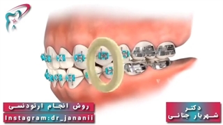 انیمیشن ارتودونسی و اصلاح فک