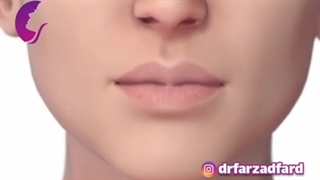 فیلمی کامل از چگونگی تزریق ژل به لب