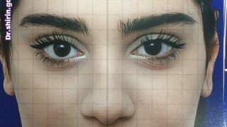 جراحی زیبایی بینی