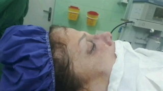 جراحی زیبایی بینی