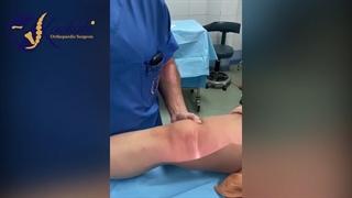 فیلم بازسازی رباط صلیبی قهرمان تیم ملی کاراته ایران جهت بازگشت به مسابقات