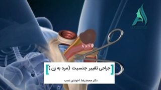 جراحی تغییر جنسیت مرد به زن