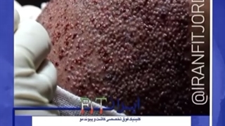 کلینیک تخصصی کاشت مو ایران FIT