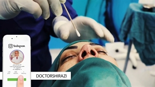 فیلم کامل جراحی بینی گوشتی