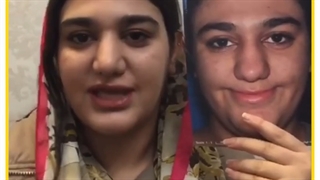 رضایت از عمل بینی