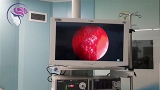 جراحی بدون سانسور سینوس پیشانی در آقای جوان