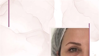 موضوع: تزریق جالپرو ( رفع سیاهی زیر چشم)