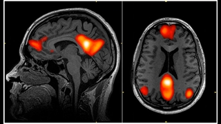 فعالیت ذهنی و مغزی کودکان در هنگام خواندن کتاب داستان توسط مادر و مقایسه آن با تماشای تلویزیون