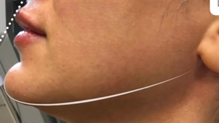 بهترین تکنیک زاویه سازی فک