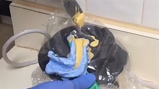 نحوه قالب گیری دندان