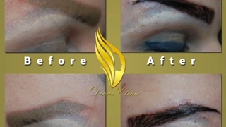 فیلم قبل و بعد کاشت ابرو