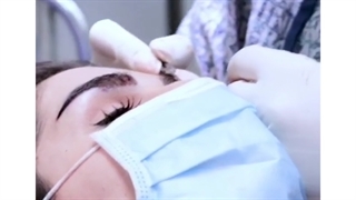 فیلم بدون سانسور کاشت ابروی طبیعی