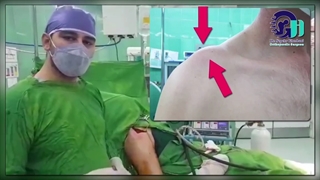 بازسازی لیگمانی و درمان آسیب قدیمی در آقای 45 ساله