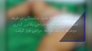 پلاتین گذاری در استخوان پای کودک 5 ساله