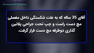 شکسته شدن مچ دست در آقای 37 ساله