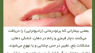 راهنمای کنترل عارضه زخم دهان بعد از رادیوتراپى