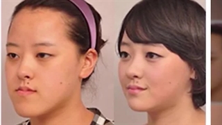 ‎جراحی زیبایی ترکیبی به سبک کره‌ای