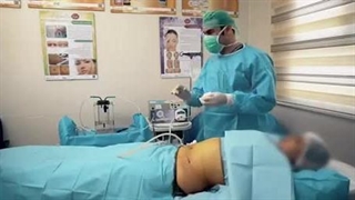 دستگاه پزشکی Lipo Modeling (پارت3)