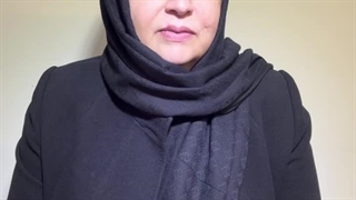 کاشت ابرو در تهران