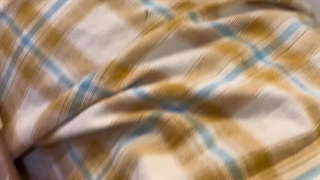 حذف تتو با لیزر کیوسوییج