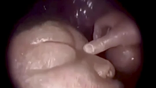 ویدئو از جنین داخل رحم