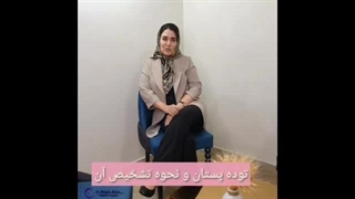 توده های پستان