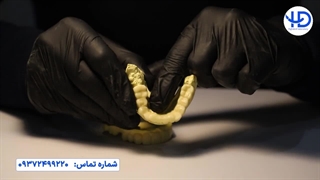 اسنپ اسمایل (تحلیل کیس کاری یک)