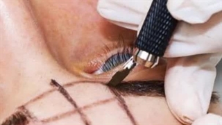 چرا میکروبلیدینگ نکنیم