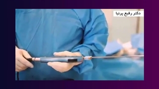 معرففی دستگاه لیپوماتیک