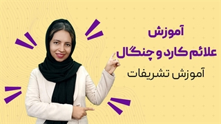 علائم کارد و چنگال در هتل ها و رستوران ها