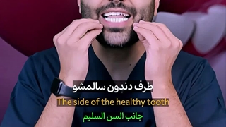 دندون سالم میرزه نهایی1