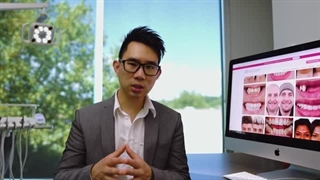 بستن فاصله دندان