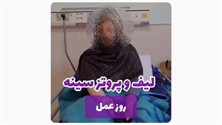 لیفت و پروتز در مشهد