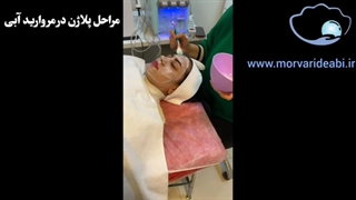 تاثیر پلاژن تراپی بر پوست