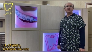 تغییرات حرارتی و تاثیر آن بر دندان