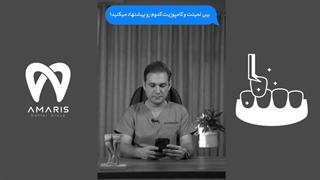 کامپوزیت یا لمینیت دندان؟