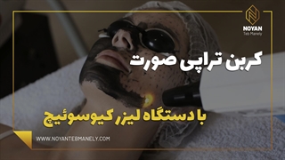 مراحل انجام پیلینگ کربن برای کاهش منافذ باز و روشن سازی پوست صورت لیفت ابرو