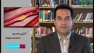 درباره آنژین صدری بیشتر بدانیم