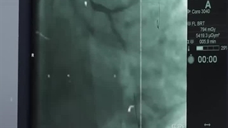 مته الماسه چیست؟