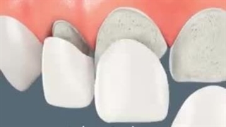دکتر پویا باقری پاکسازی پوست