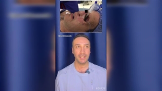 توضیح کامل کیس ریپورت ترانس اوربیتال انتوباسیون