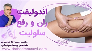 میدونی بهترین راه درمان سلولیت ران چیه