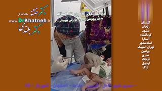 فیلم واقعی بیحسی ختنه نوزاد ۲۱ روزه استاد دکتر بلندی