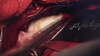 کلینیک مغز و اعصاب دکتر صمدیان https://pezeshka.net/