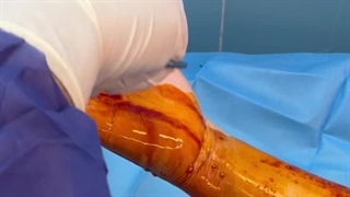 دستتو نجات بده قبل از اینکه دیر بشه،دکتر وحید شاملی متخصص ارتوپد کلینیک درد مهرگان.