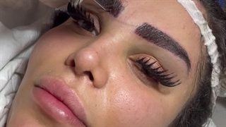 مراقبت بعد از کاشت ابرو در مجموعه هیلدا آکنه